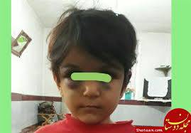 تحقیق کودک آزاری
